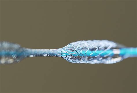 Nitinol: Un Materiale Intelligente per l'Impianto di Stents e la Robotica Avanzata!